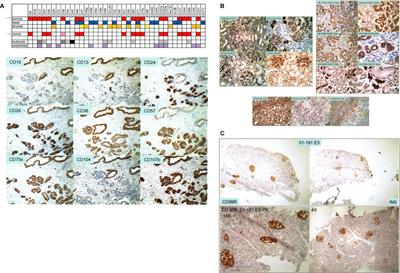 Prostate cancer research: tools, cell types, and molecular targets